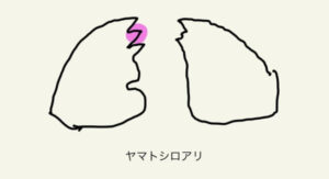 ヤマトシロアリ 大顎の形